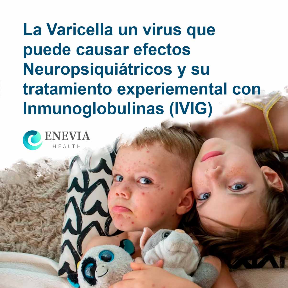 La Varicella un virus que puede causar efectos Neuropsiquiátricos y su tratamiento experiemental con Inmunoglobulinas (IVIG)