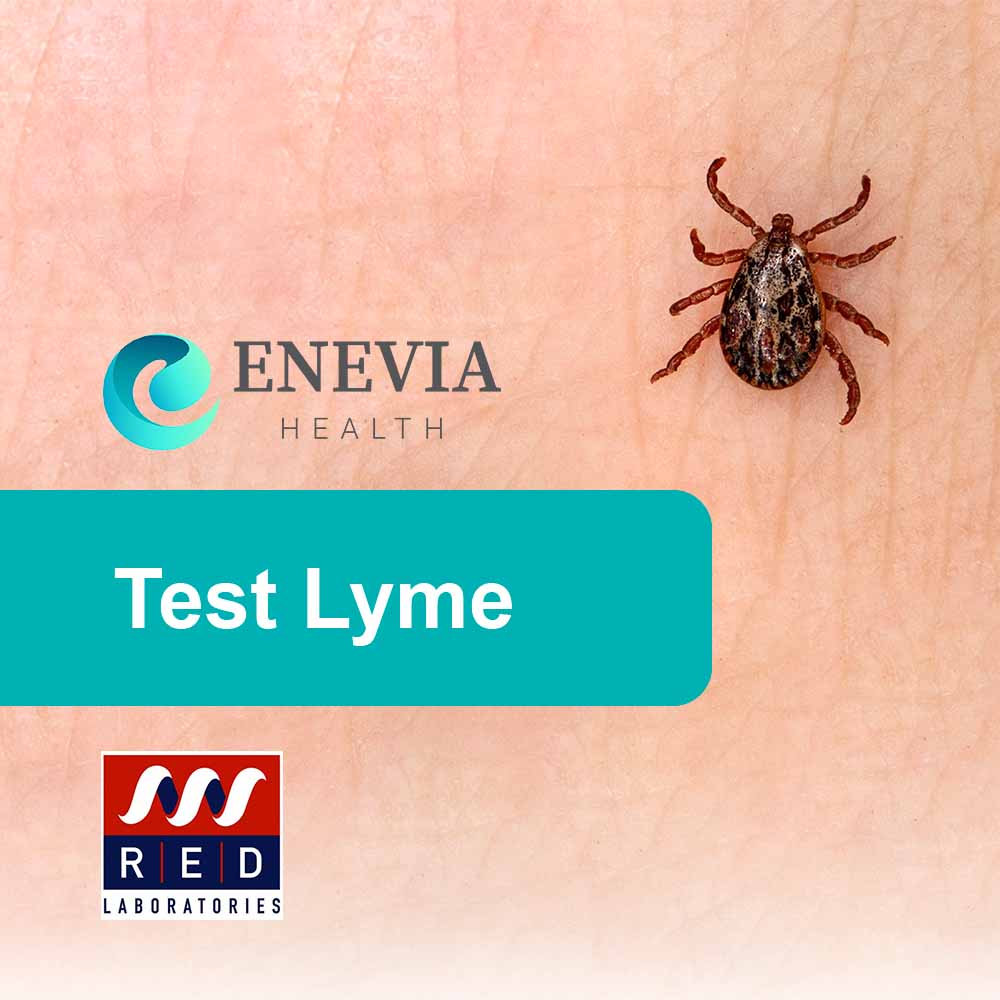 Test Lyme RedLabs